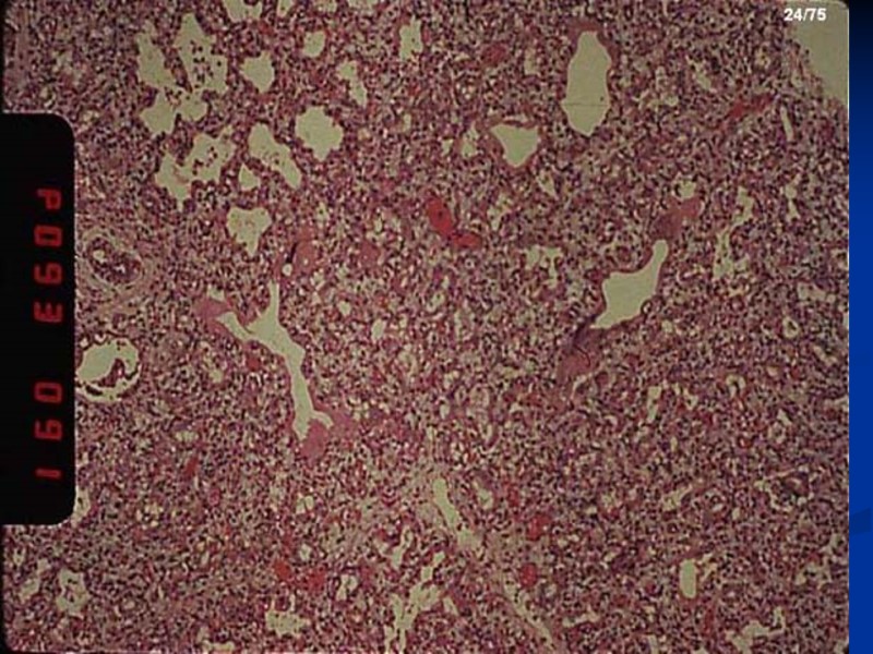 Histology of lung